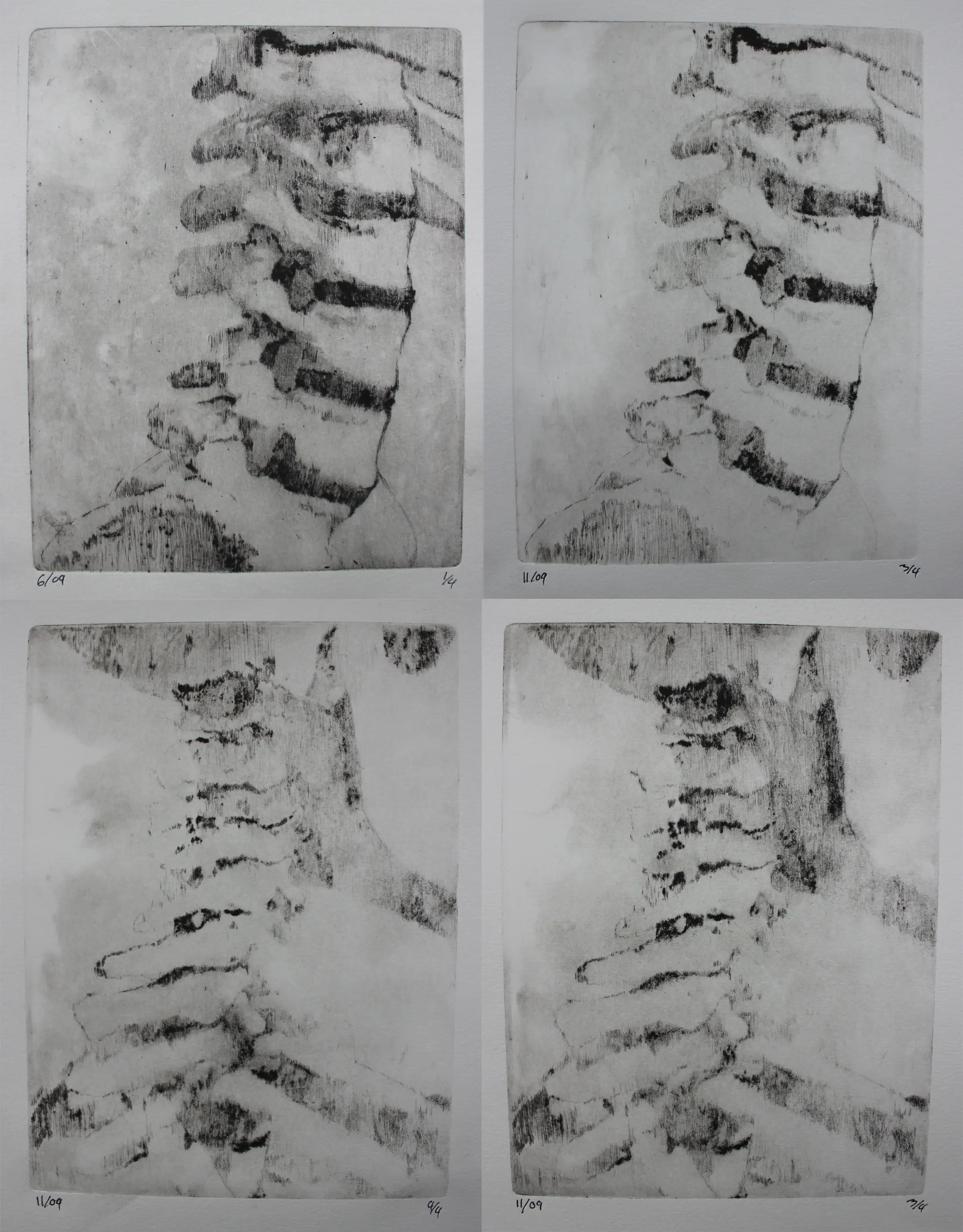 Cervical vertebrae in thought (2017)